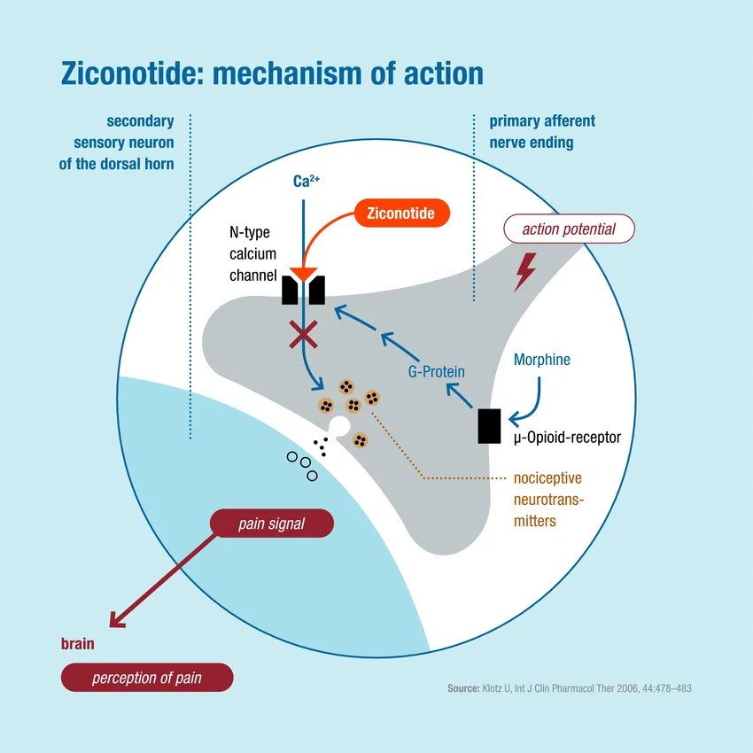 Mechanisms-of-action-of-ziconotide-a-nonopioid-analgesic-administered-intrathecally-for
