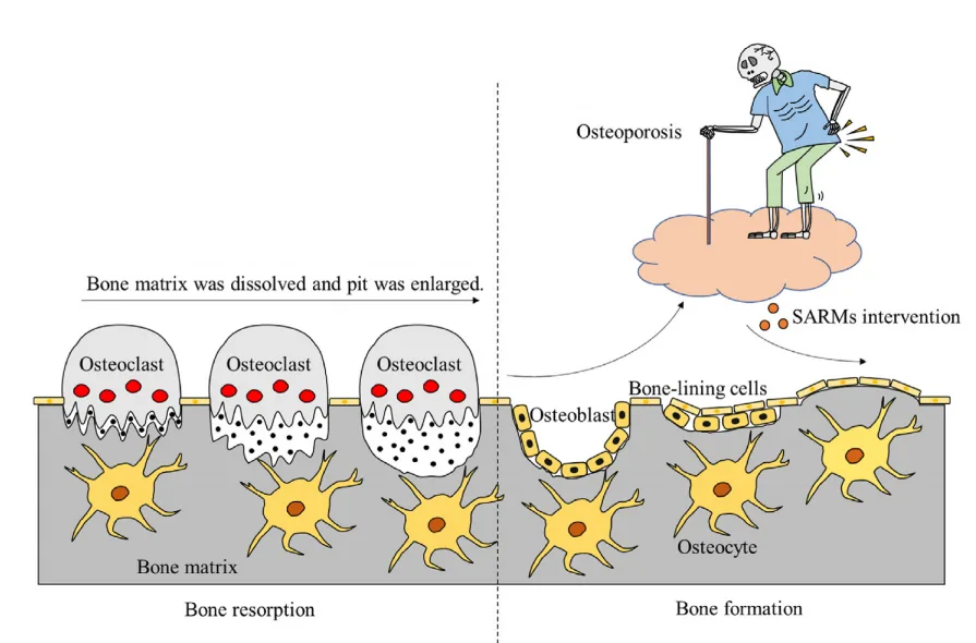 Redefining Bone Health: A New Era with Selective Androgen Receptor Modulators(images 3)