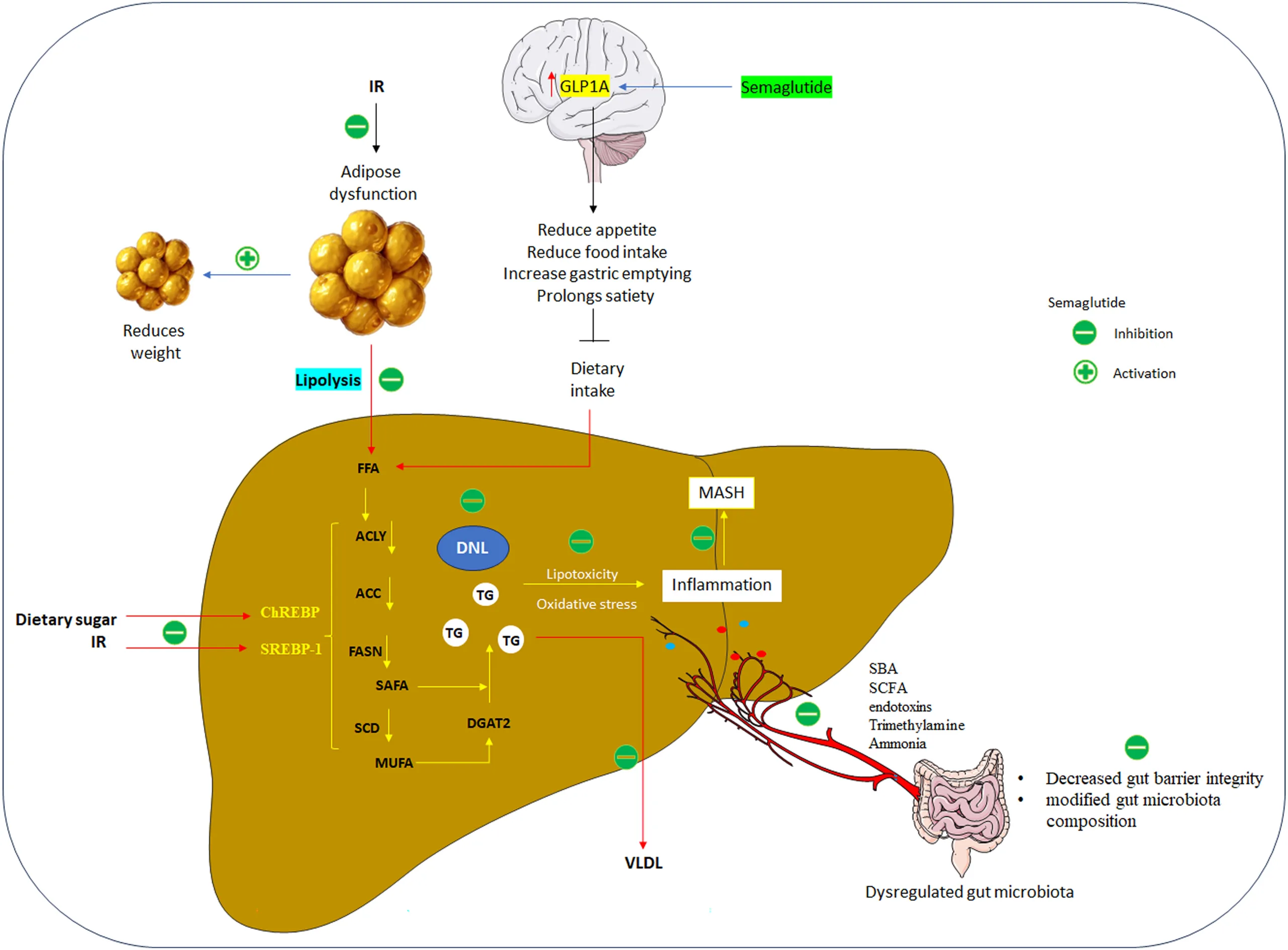 Is Semaglutide the Master Key for MASH? Mechanistic Insights and Clinical Evidence（images 2）